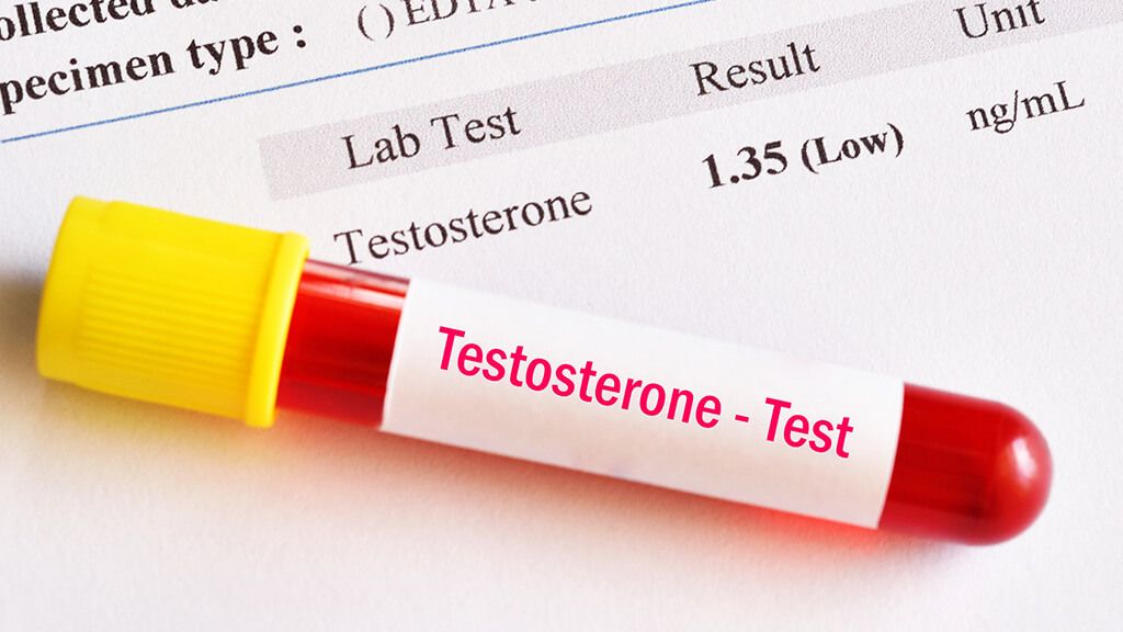 Máte dostatok testosterónu? Otestuje sa hneď teraz! Zaberie vám to 5 minút. - Urocentrum Poradňa