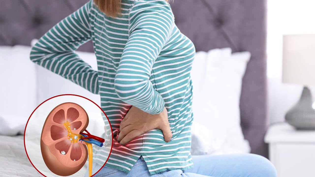 Neignorujte týchto 5 hlavných príznakov ochorenia obličiek - Urocentrum Poradňa