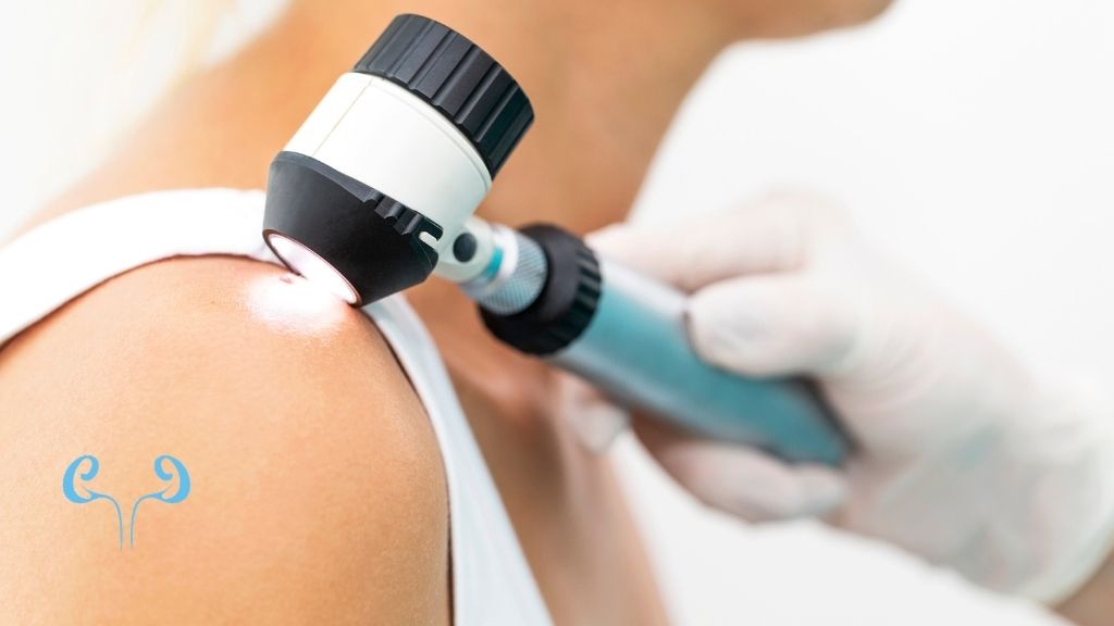 Rakovina kože nemusí byť len zo slnka: Čo s tým má spoločné HPV?